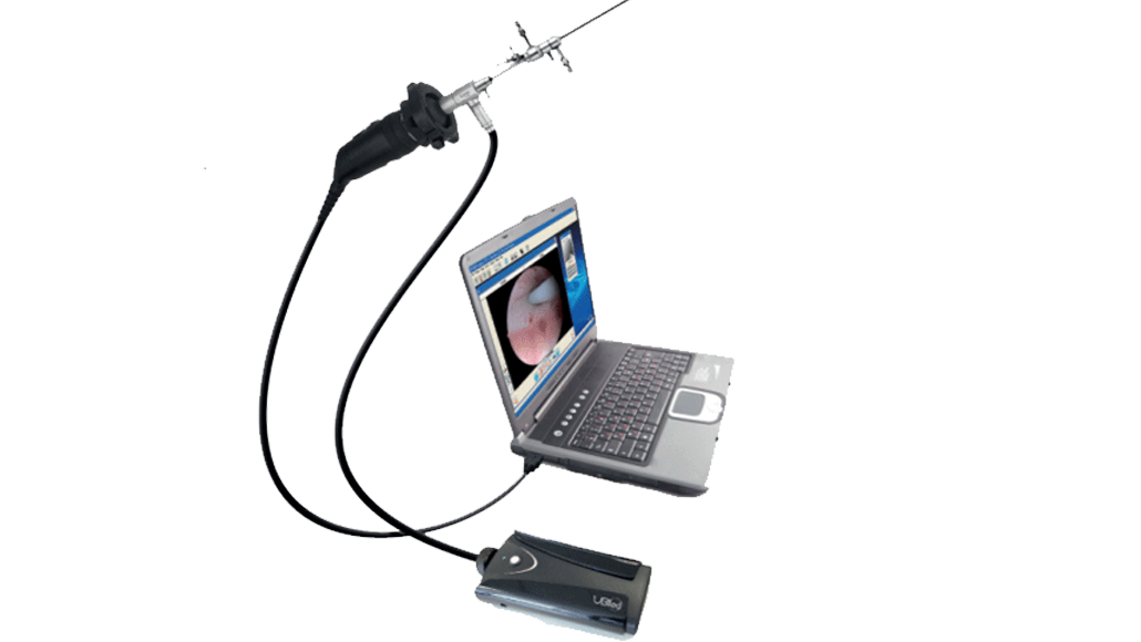 Комплекс для проведения офисной гистероскопии UBIPACK GYN 